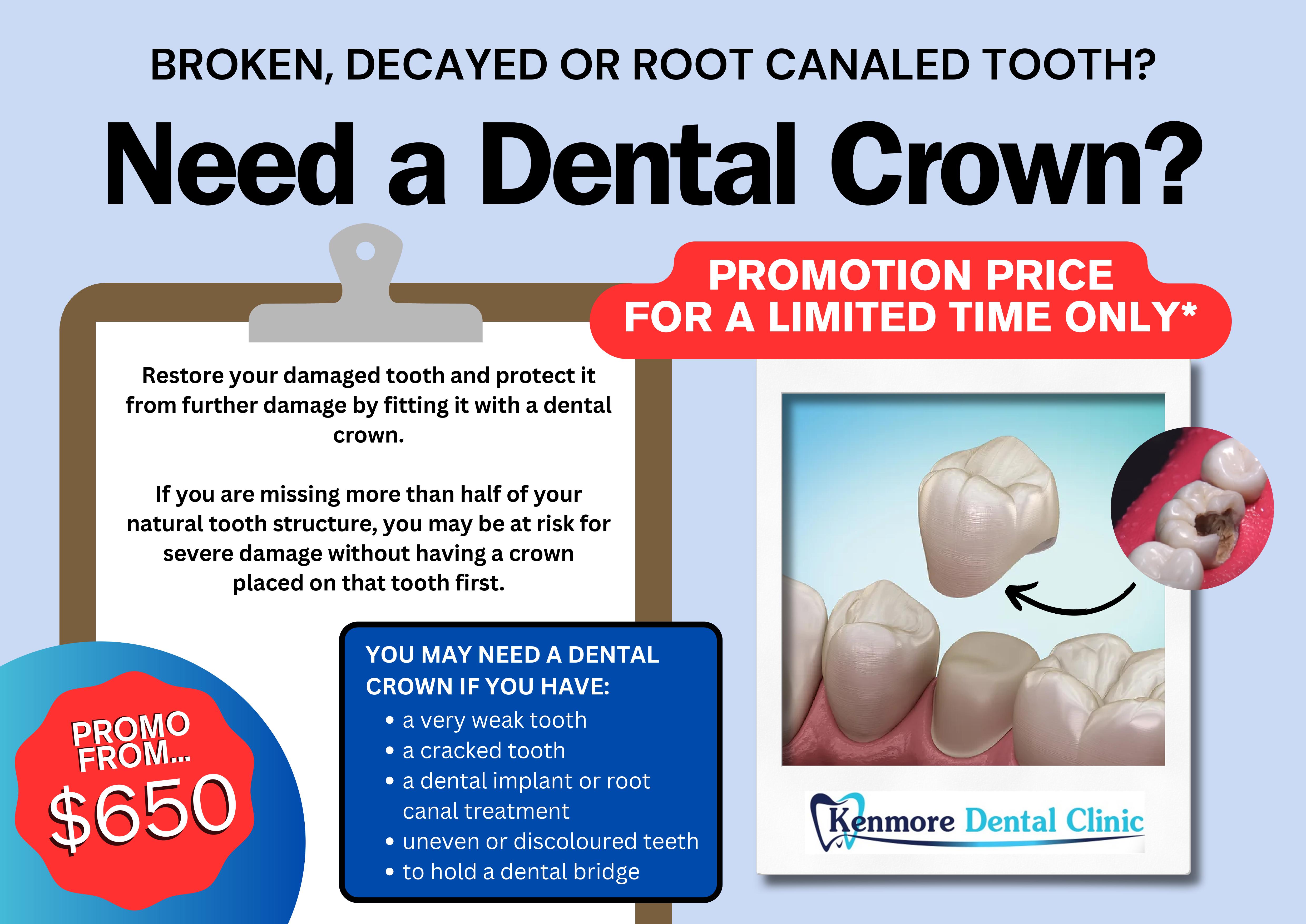 Dental crown promotion